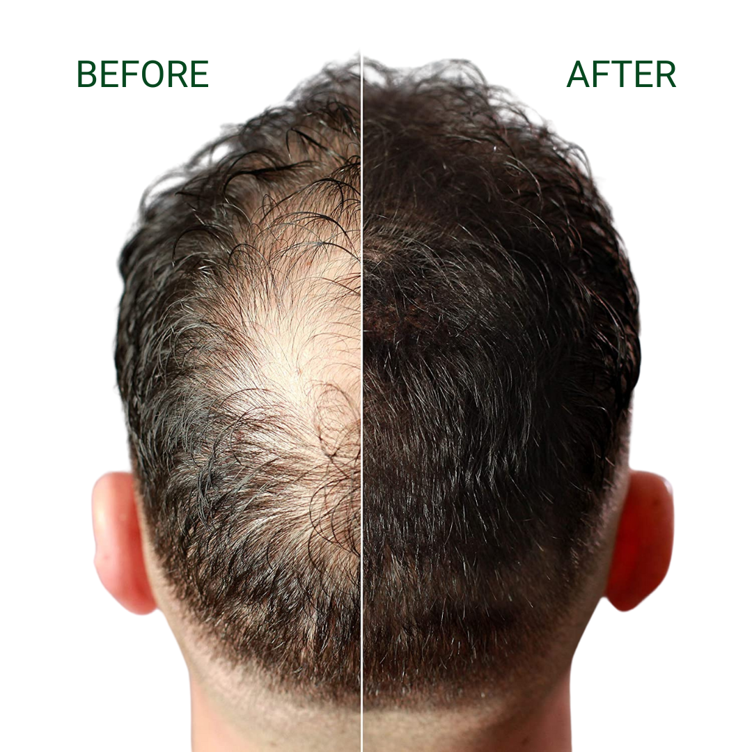FIBR Keratin Hair Fibers (25g)