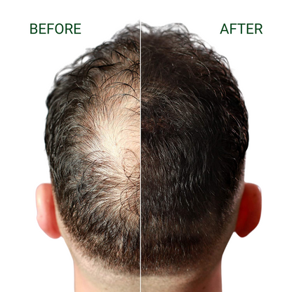 FIBR Keratin Hair Fibers (25g)